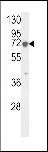 KRT9 Antibody in Western Blot (WB)