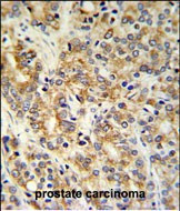TXNDC12 Antibody in Immunohistochemistry (Paraffin) (IHC (P))