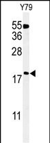 TXNDC12 Antibody in Western Blot (WB)