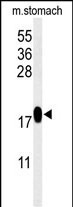 TXNDC12 Antibody in Western Blot (WB)