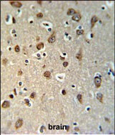 YME1L1 Antibody in Immunohistochemistry (Paraffin) (IHC (P))