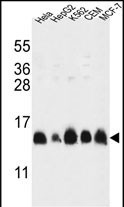 HIST1H2AG Antibody in Western Blot (WB)