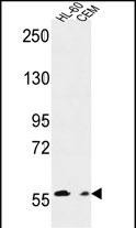 MICALL2 Antibody in Western Blot (WB)