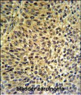 FUT6 Antibody in Immunohistochemistry (Paraffin) (IHC (P))