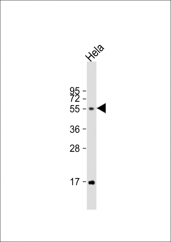 FUT6 Antibody in Western Blot (WB)