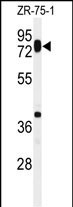 HAS1 Antibody in Western Blot (WB)