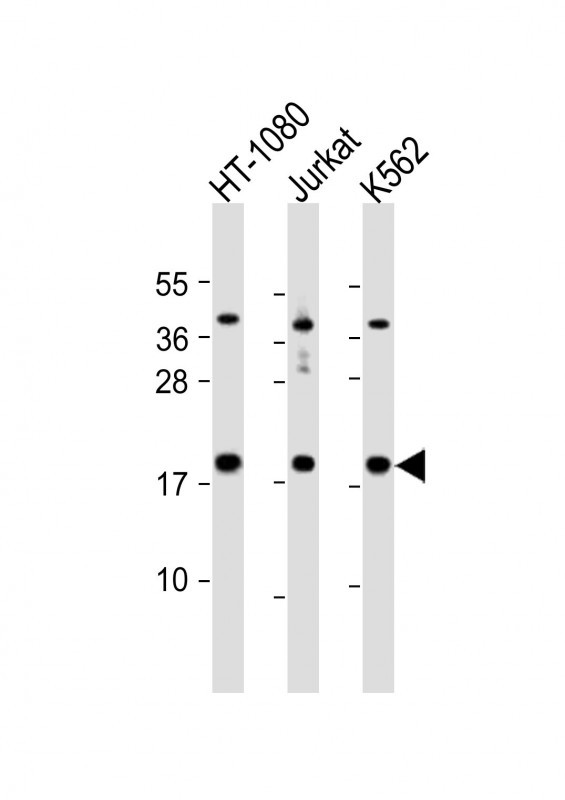 NAT13 Antibody in Western Blot (WB)