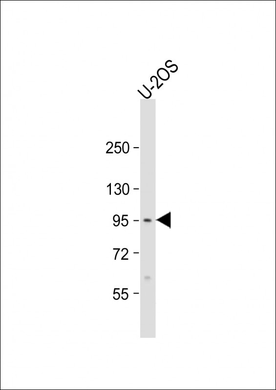 EPC2 Antibody in Western Blot (WB)