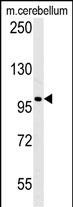 EPC2 Antibody in Western Blot (WB)