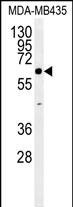 ERO1LB Antibody in Western Blot (WB)