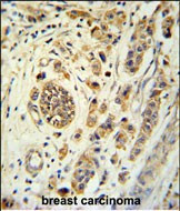 FBXL15 Antibody in Immunohistochemistry (Paraffin) (IHC (P))