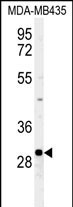 FBXL15 Antibody in Western Blot (WB)