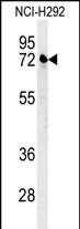 KLHL24 Antibody in Western Blot (WB)