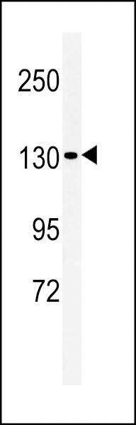 L1TD1 Antibody in Western Blot (WB)