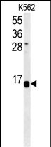 HIST1H2AG Antibody in Western Blot (WB)