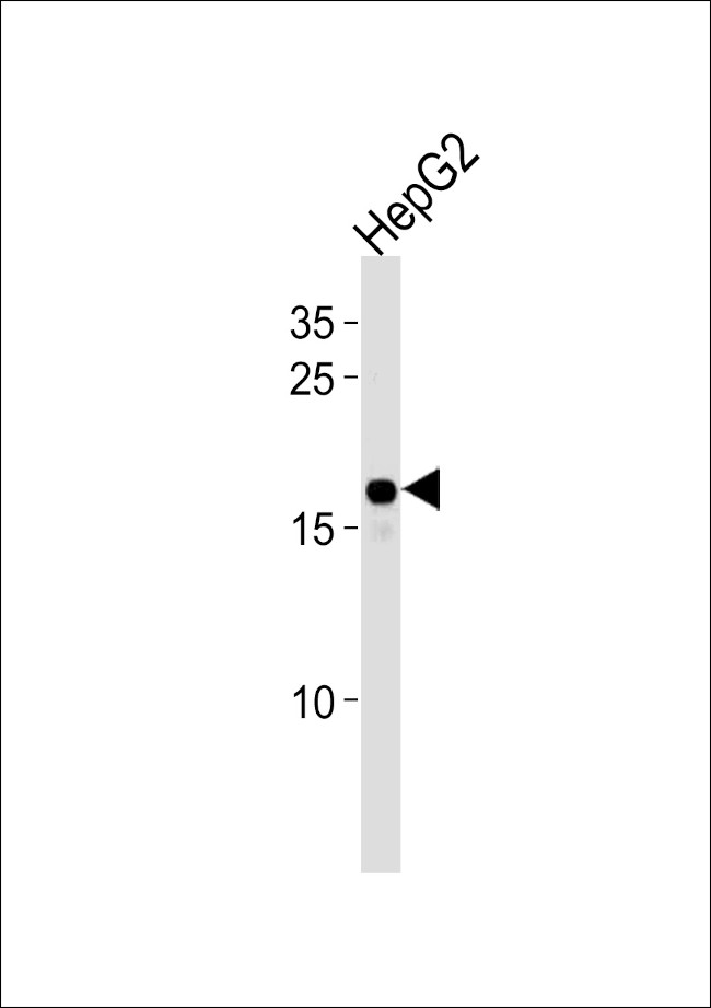 HMGA2 Antibody in Western Blot (WB)