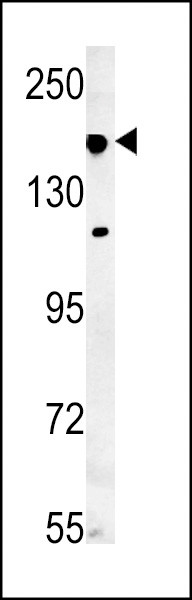 IFT172 Antibody in Western Blot (WB)