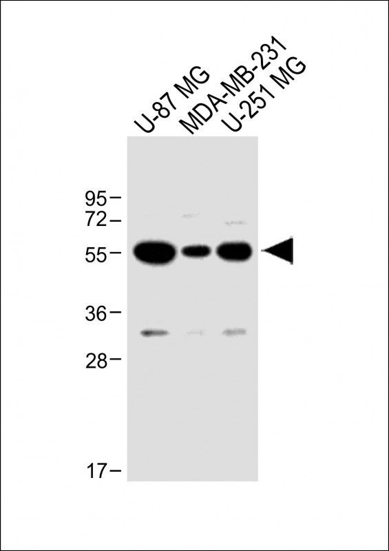 USP17 Antibody in Western Blot (WB)