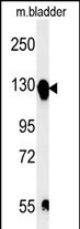 ITGA5 Antibody in Western Blot (WB)