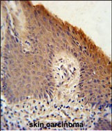 KRTAP1-1 Antibody in Immunohistochemistry (Paraffin) (IHC (P))