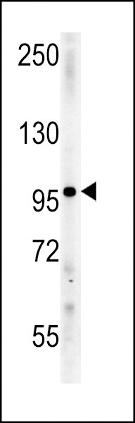 Importin 9 Antibody in Western Blot (WB)