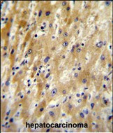 HABP2 Antibody in Immunohistochemistry (Paraffin) (IHC (P))