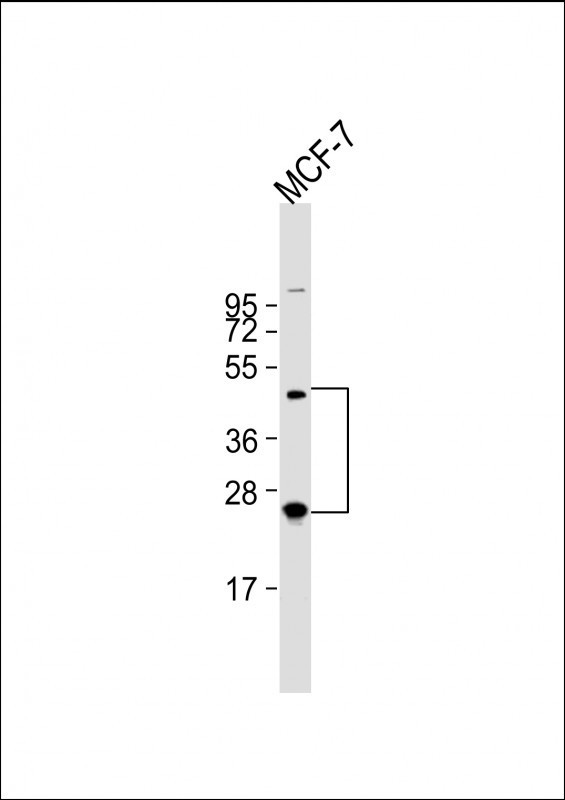 HABP2 Antibody in Western Blot (WB)