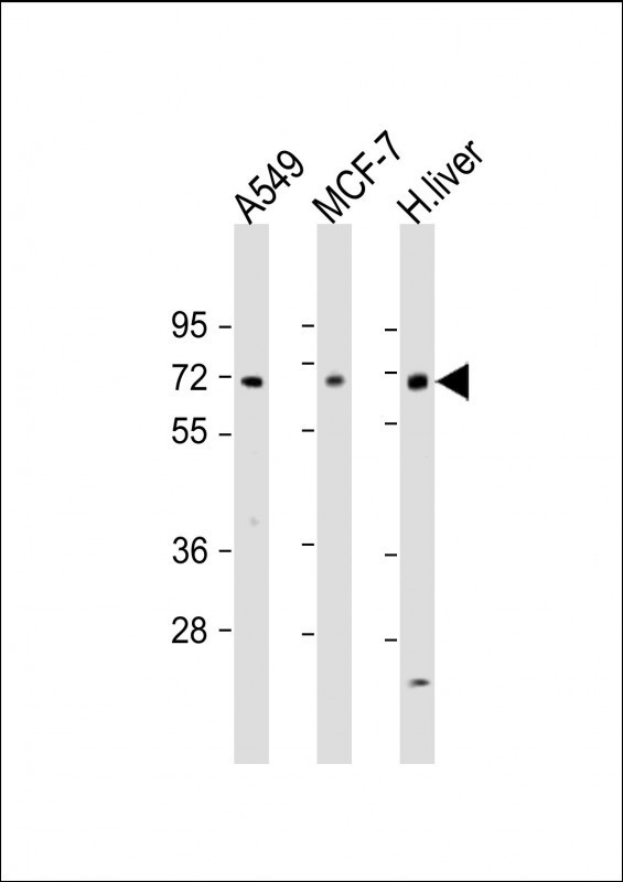 HABP2 Antibody in Western Blot (WB)