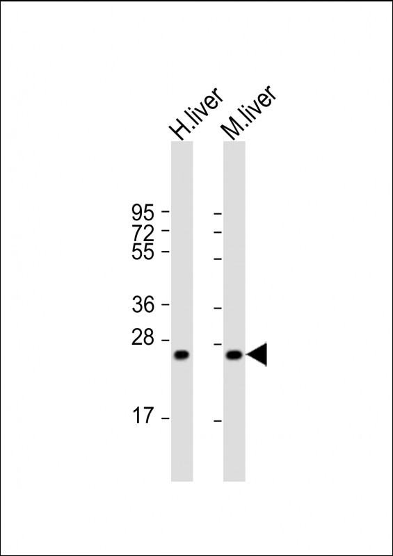 HABP2 Antibody in Western Blot (WB)