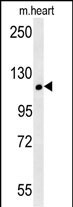 CRB2 Antibody in Western Blot (WB)