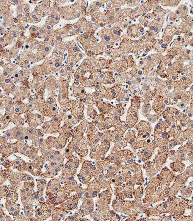 HSD17B13 Antibody in Immunohistochemistry (Paraffin) (IHC (P))