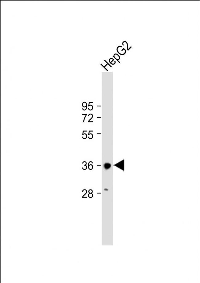 HSD17B13 Antibody in Western Blot (WB)