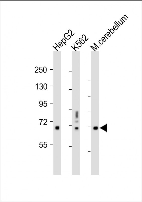 TCF4 Antibody in Western Blot (WB)