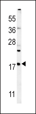 VAMP4 Antibody in Western Blot (WB)