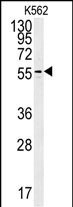 PAOX Antibody in Western Blot (WB)