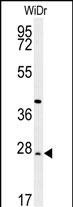 DIRAS3 Antibody in Western Blot (WB)