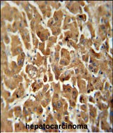 ATP5G2 Antibody in Immunohistochemistry (Paraffin) (IHC (P))