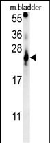 ATP5G2 Antibody in Western Blot (WB)