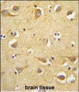 Clathrin Heavy Chain Antibody in Immunohistochemistry (Paraffin) (IHC (P))