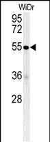 C4BPA Antibody in Western Blot (WB)