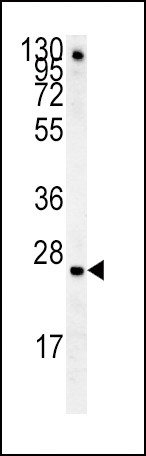 IGFBP4 Antibody in Western Blot (WB)