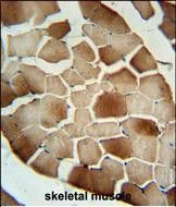 Complement Factor B Antibody in Immunohistochemistry (Paraffin) (IHC (P))