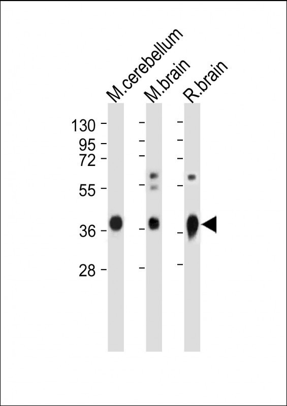 GNAO1 Antibody in Western Blot (WB)