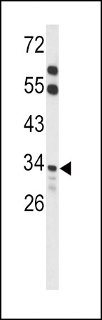 ACOT8 Antibody in Western Blot (WB)