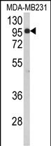 BAHD1 Antibody in Western Blot (WB)