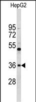 ELOVL2 Antibody in Western Blot (WB)