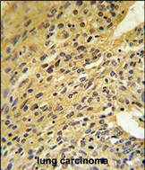 COQ5 Antibody in Immunohistochemistry (Paraffin) (IHC (P))