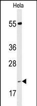 Cyclophilin C Antibody in Western Blot (WB)