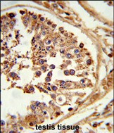 HSL Antibody in Immunohistochemistry (Paraffin) (IHC (P))