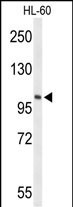 HSL Antibody in Western Blot (WB)